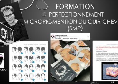 SMP.Micropigmentation du cuir chevelu,formations, ysabel marignan tricopigmentation Nîmes