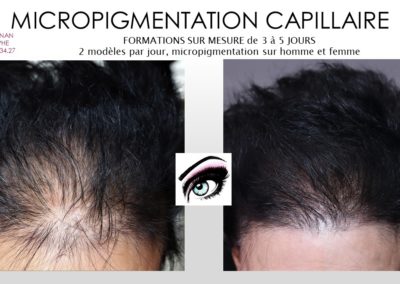 densification des cheveux, solution calvitie feminine, ysabel marignan nimes, montpellier,avignon,marseille