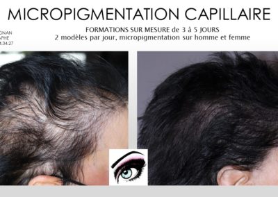 densification de crane micropigmentation capillaire nimes,montpellier,marseille,avignon , solutions alopecie féminine, ysabel marignan