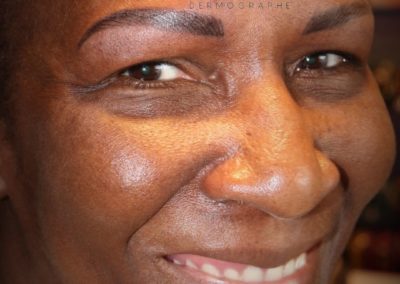 tatouage sourcils avant chimiotherapie institut du sein nîmes, diane réseau sein du gard, prise en charge des sourcils pendant cancer, nîmes, montpellier,avignon, alès, arles