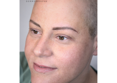 maquillage permanent nimes tatouage sourcils avant chimiotherapie institut du sein nîmes, diane réseau sein du gard, prise en charge des sourcils pendant cancer, nîmes, montpellier,avignon, alès, arles